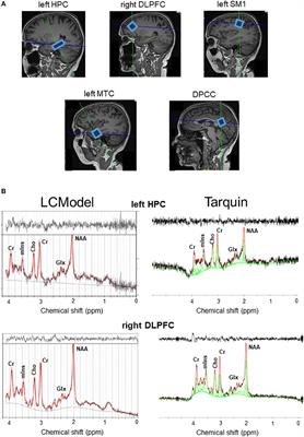 Inflammatory Blood Biomarker Kynurenine Is Linked With Elevated Neuroinflammation and Neurodegeneration in Older Adults: Evidence From Two 1H-MRS Post-Processing Analysis Methods